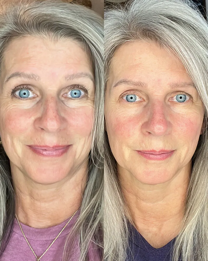 Before & After Using DUOLAB