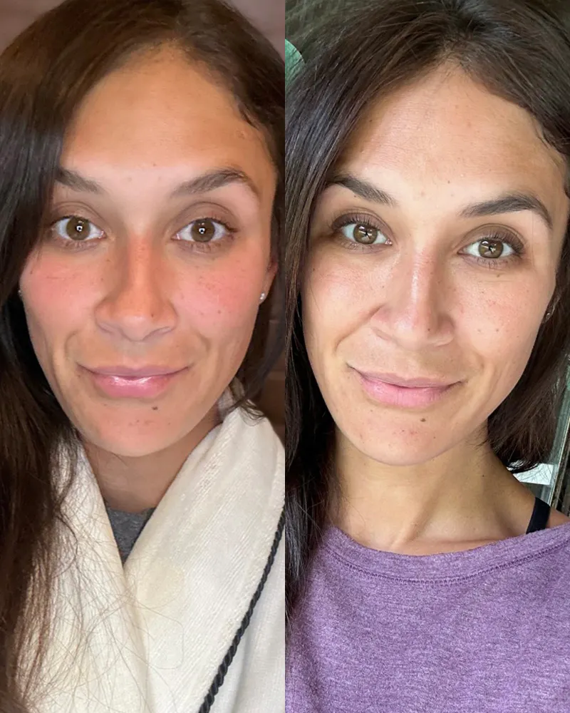 Before & After Using DUOLAB