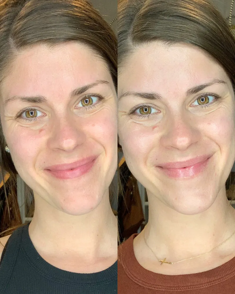 Before & After Using DUOLAB