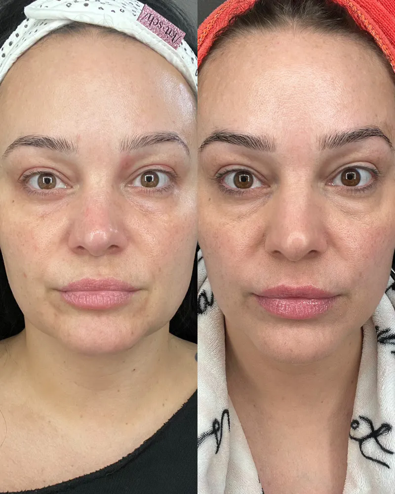 Before & After Using DUOLAB