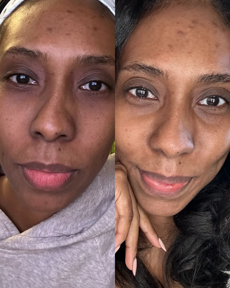 Before & After Using DUOLAB