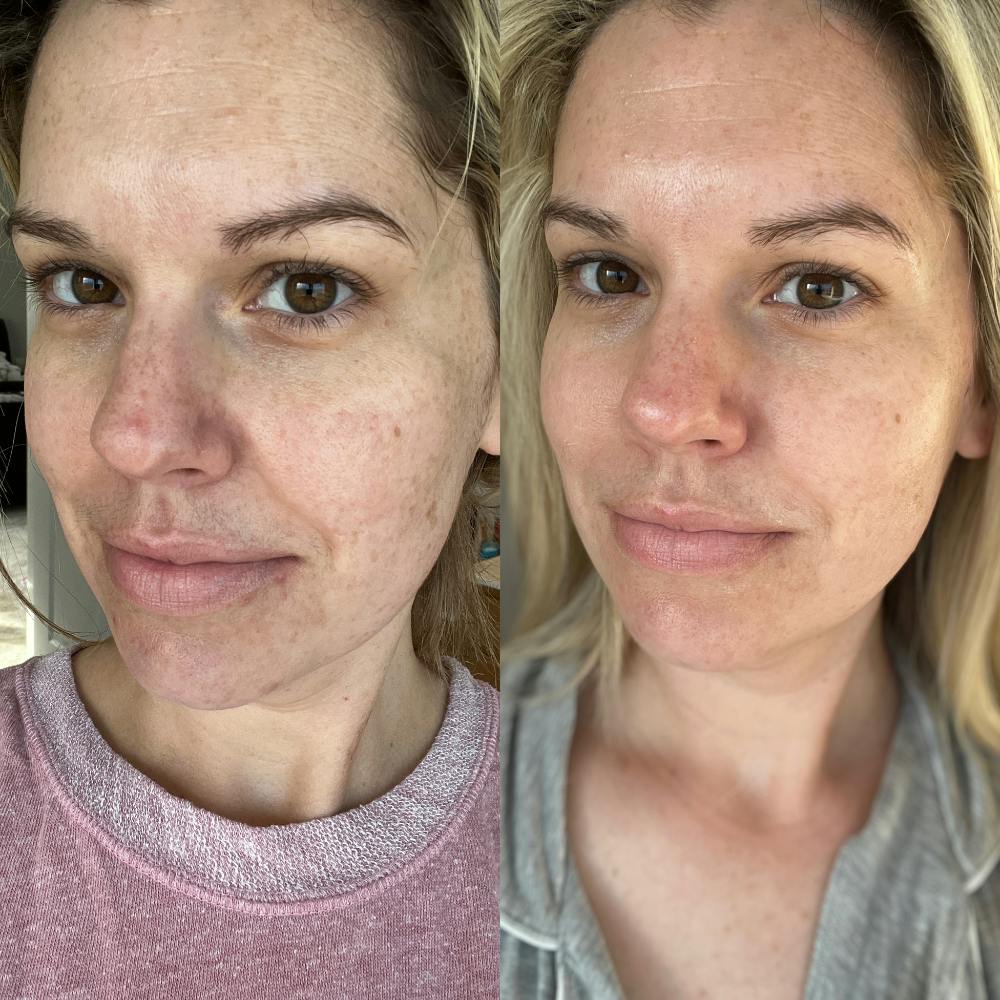 Before & After using DUOLAB