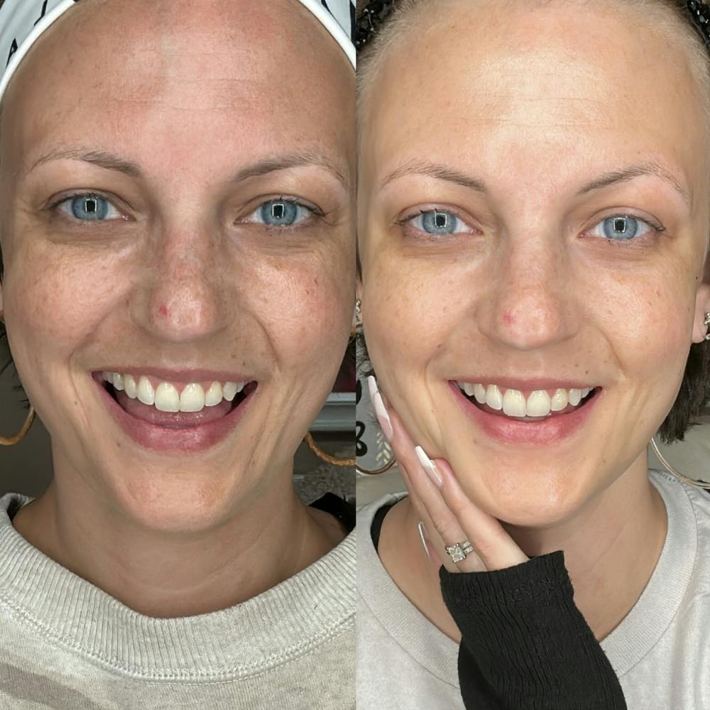 Before & After using DUOLAB