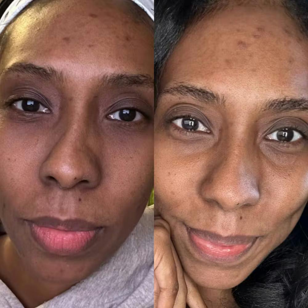 Before & After using DUOLAB