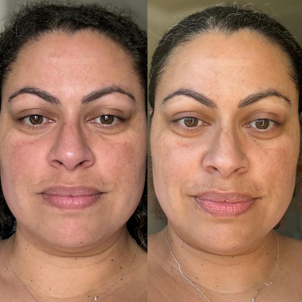 Before & After using DUOLAB
