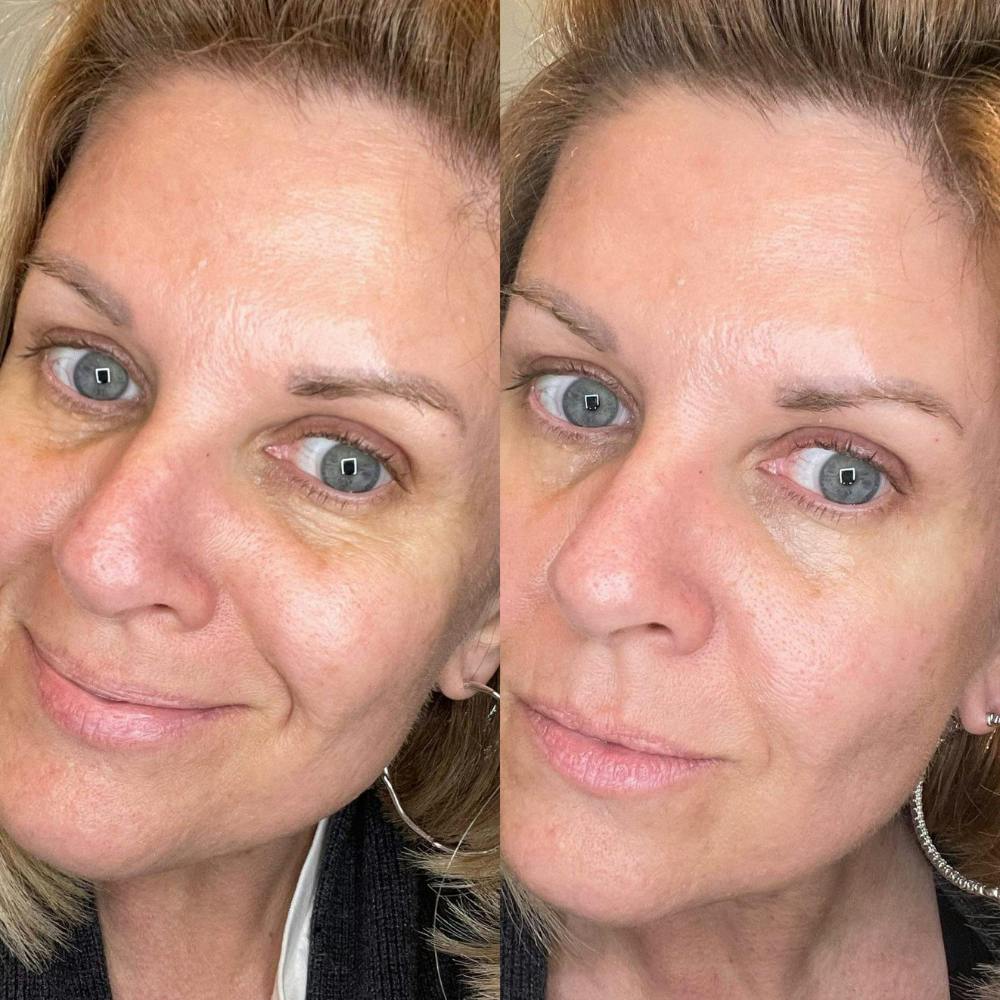 Before & After using DUOLAB