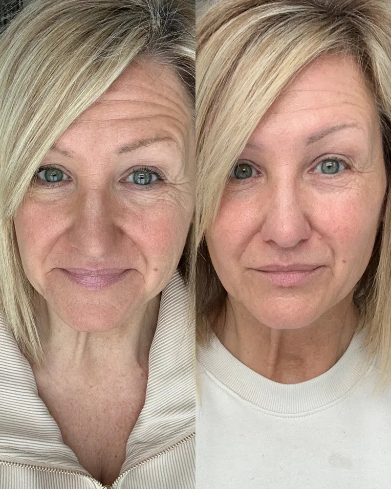 Before & After Using DUOLAB