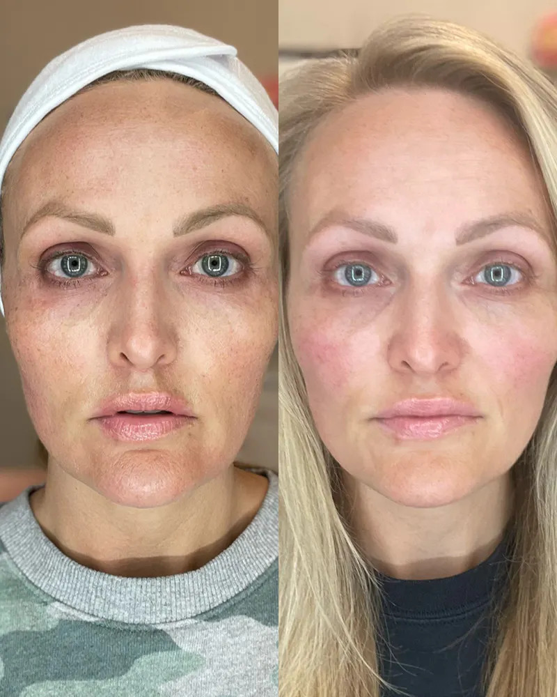 Before & After Using DUOLAB